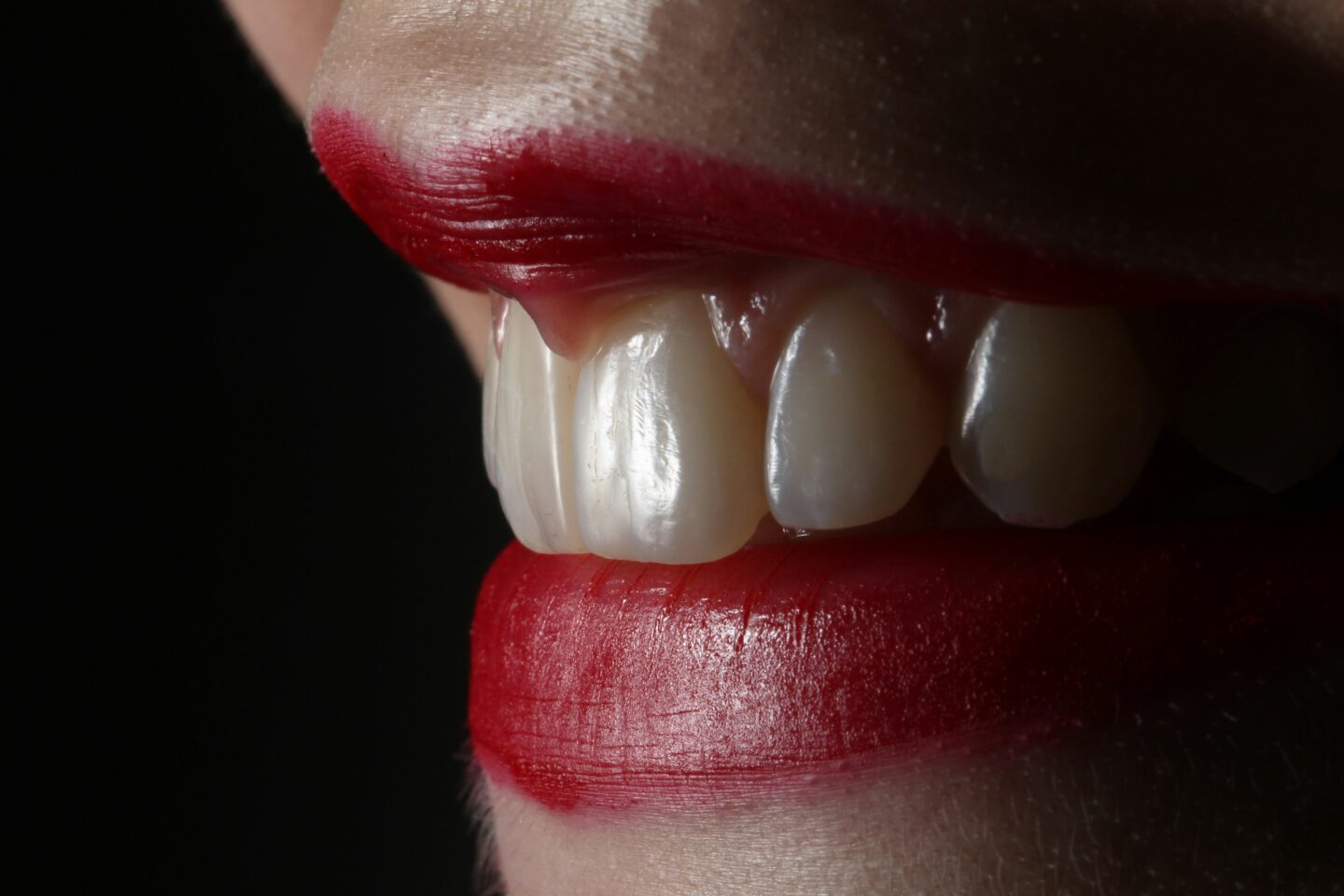 The Ultimate Guide to Dentist-Led Teeth Whitening